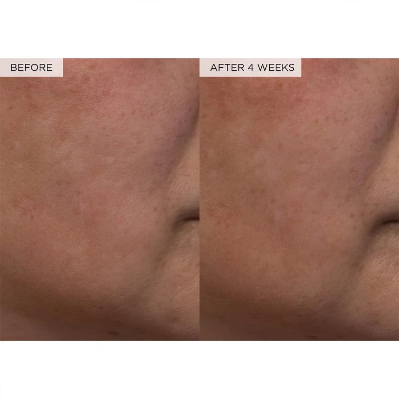 150ml WATERMELON Brighteing Face Toner & Pore Minimizer with Hyaluronic Acid Makeup Primer, Pore Minimizer & Niacinamide Serum