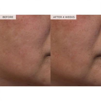 150ml WATERMELON Brighteing Face Toner & Pore Minimizer with Hyaluronic Acid Makeup Primer, Pore Minimizer & Niacinamide Serum