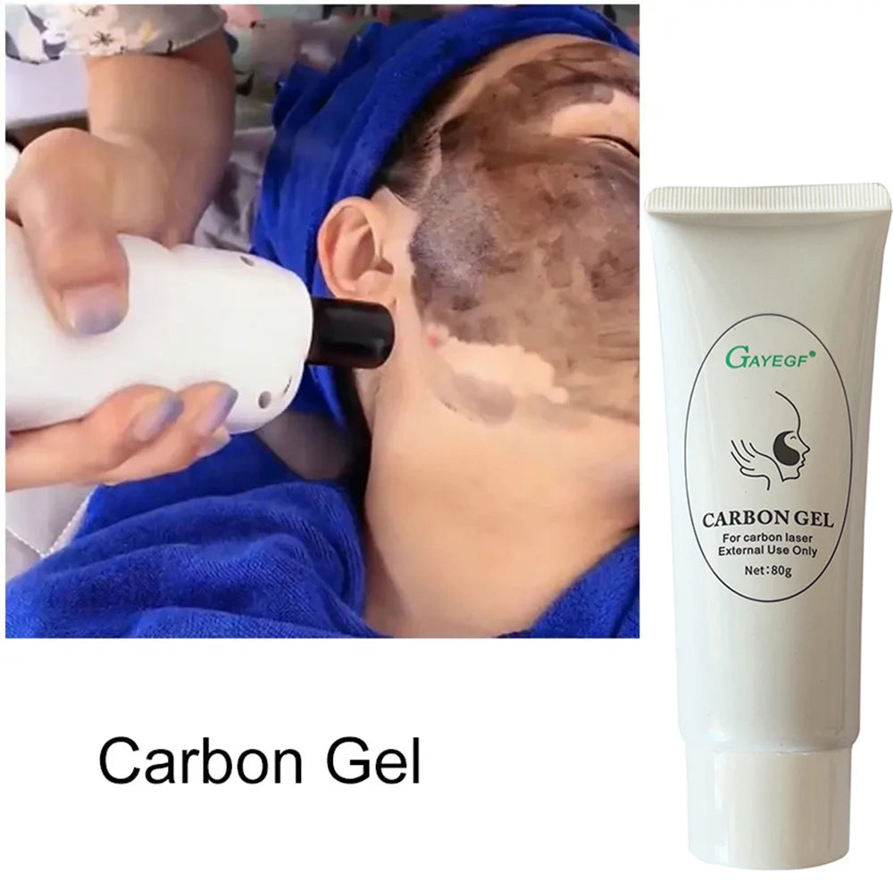 2/5pcs Black Gel Face Mask – Laser Peeling, Whitening & Skin Rejuvenation