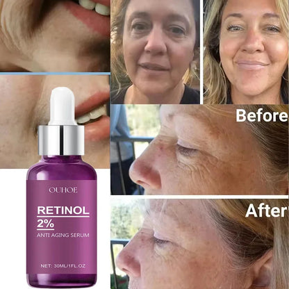 Retinol Wrinkle Repair Face Serum – Anti-Aging, Firming & Brightening Moisturizer