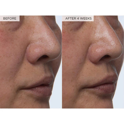 150ml WATERMELON Brighteing Face Toner & Pore Minimizer with Hyaluronic Acid Makeup Primer, Pore Minimizer & Niacinamide Serum