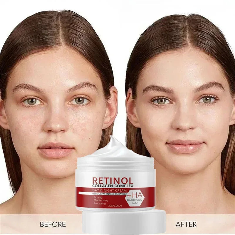 Face & Body Whitening Cream – Retinol, Collagen & Hyaluronic Acid 3-in-1