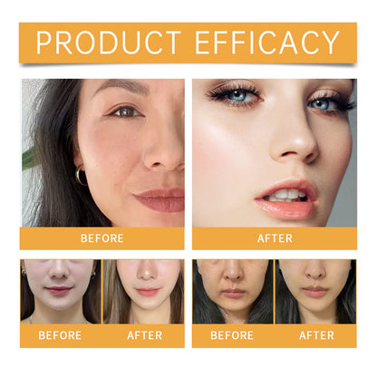 Nasolabial Folds Collagen Patch – Anti-Wrinkle, Firming & Deep Moisturizing