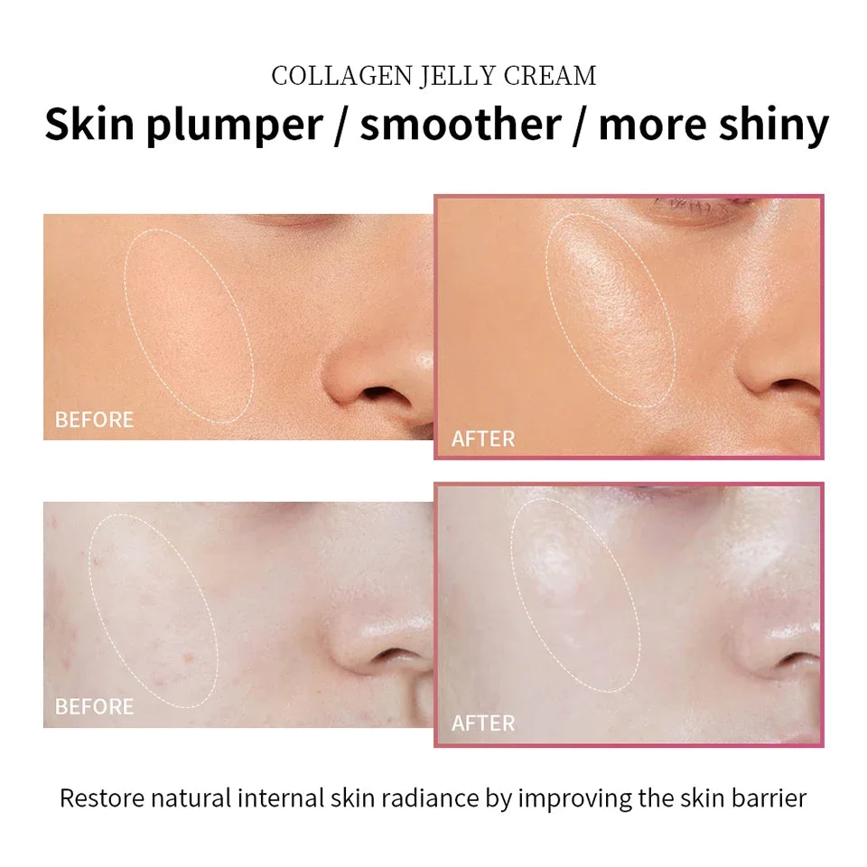 Collagen Niacinamide Jelly Cream – Tightening, Soothing & Anti-Aging Face Gel