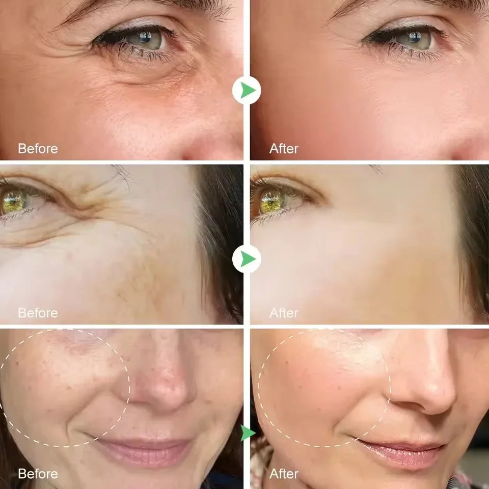 Retinol Wrinkle Repair Face Serum – Anti-Aging, Firming & Brightening Moisturizer